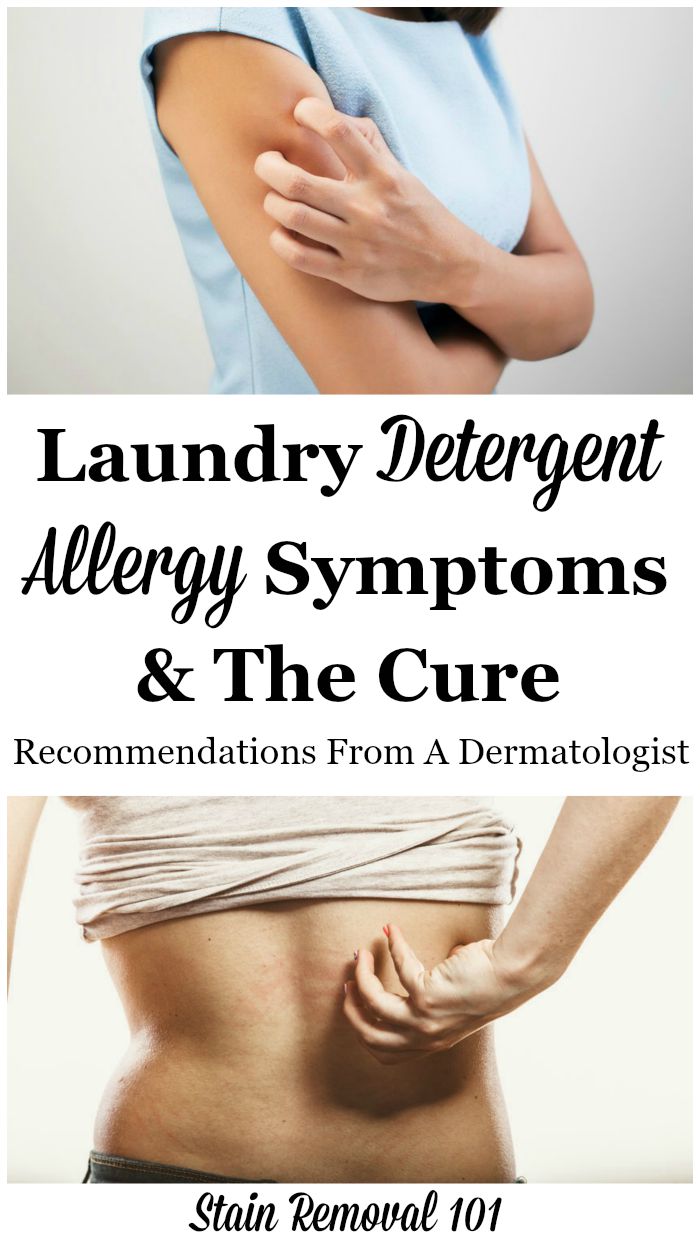 laundry-detergent-allergy-symptoms-and-the-cure