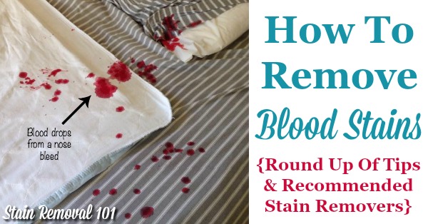 How To Remove Blood Stains: Round Up Of Tips And Stain Remover