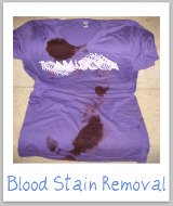 Bird Dropping Stain Removal Guide: What To Do After You Say Yuck!