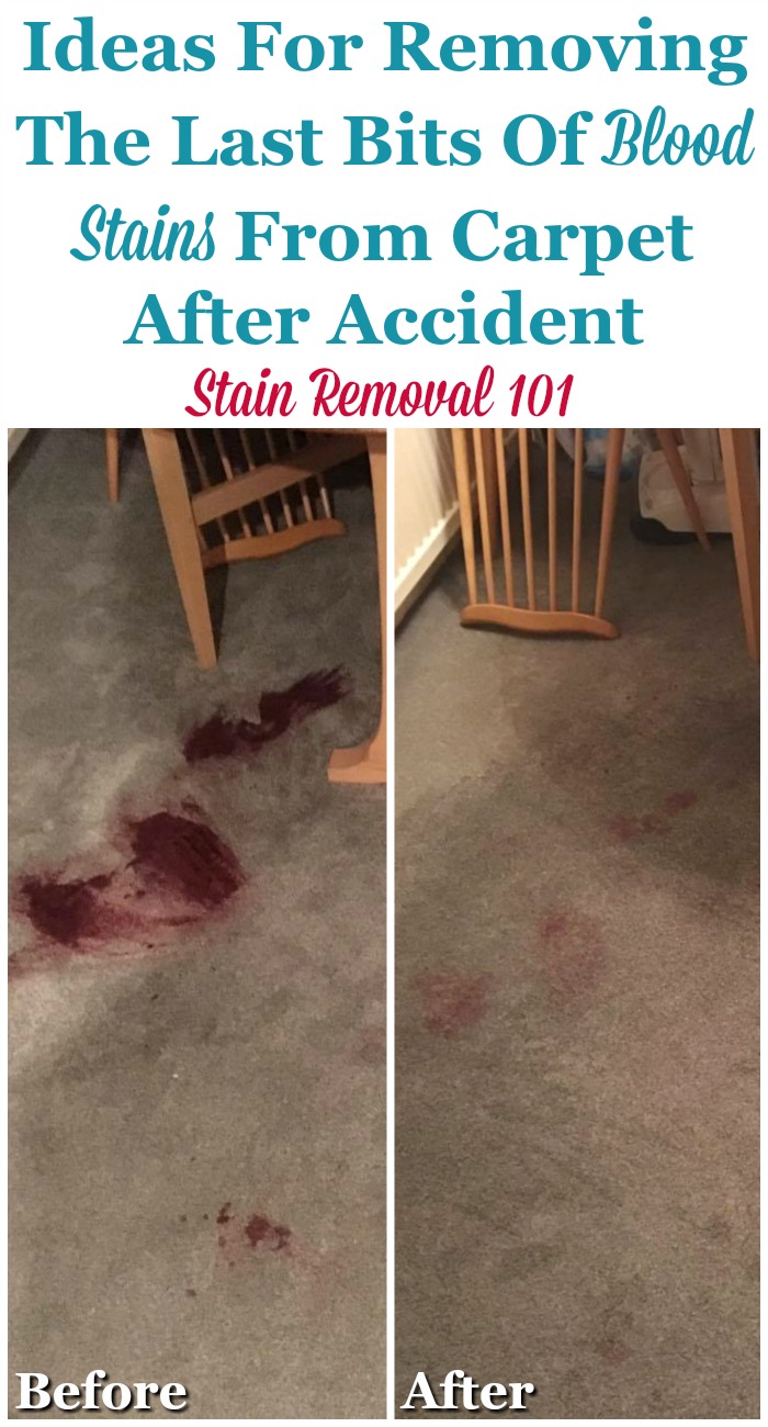 Remove Blood Stains - How to Get Out Blood Out of Carpet